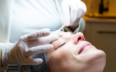 ADVANCED MICRO NEEDLING BIJ HUIDINSTITUUT FELIZ